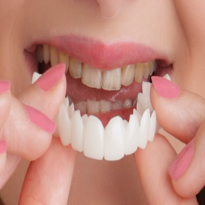 CROWNS, CAP, BRIDGES & DENTURES at Care32 Dental Implant Center nashik nampur & manmad