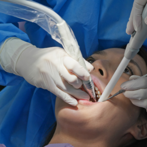 painless-root-canal care 32 dental and implant in nashik